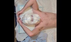 Wet Diaper Hood Treatment #5