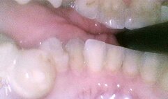 Mouth Cam - Harleen - 1080