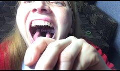 A thorough examination of the deep throat , part 2