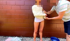 Nora's Plaster Velpeau Application