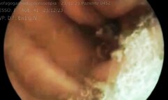Medical exam in hospital video of medical endoscopy in full screen 480avi