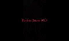 Bunions in pink dress