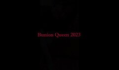 Bunions in blue dress