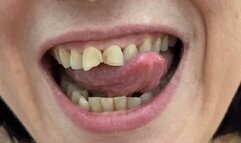 Fully dangle a cigarette with my yellow stained nicotine teeth in extreme close up