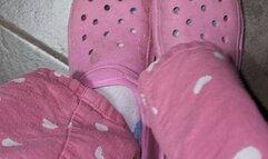 Stinky socks slowly pulled off! Hurt foot :(