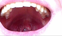 sharp fangs in the mouth