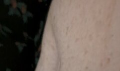 MEET MY BLOATED BELLY