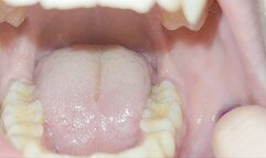 teeth tour -admire my sexy teeth