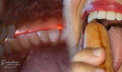 Turning you in a ridiculous sausage