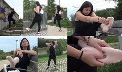 About My Bunion Part5