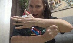 Veins on my arms and legs