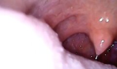 Digestion of Italian margherita pizza with lots of cheese - I swallow Pillcam Full screen exploration Vore 720HD