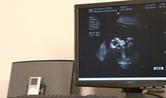 Pregnant Freak Sucks Off Male Nurse And Gets Tit Cumshot