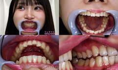 Kana Yura - Watching Inside mouth of Japanese cute girl - 1080p
