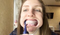 Unusual teeth cleaning