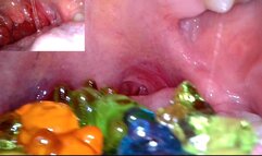 Vore- gummy bears endoscopy