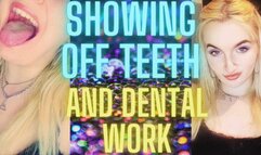 SHOWING OFF TEETH AND DENTAL WORK