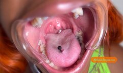 Cheek Mouth Dental Retractor Mouth Tour