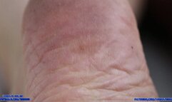 Exploring Frances' Soles