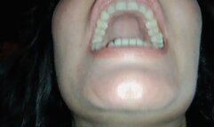 Show my mouth and teeth 8 om