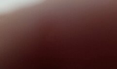 Giving a urinary lab report