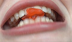 I'M RIPPING THESE LITTLE LOSERS APART!