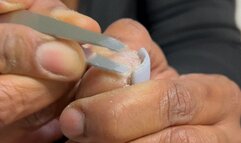 DeCrusting Of De'Feet