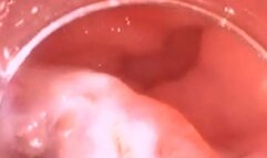 Eating Digesting Basmati Rice - Extreme Vore Exploration 720AVI