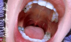 Up close Voring! Ft Ama Rio - HD MP4 1080p Format