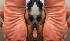 Bunions and red pedi soft cheesy soles