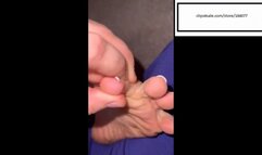 Tattoedtoesxoxo Itchy feet after cleaning