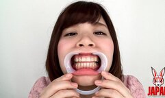 Discovering Hikaru's Dental Delights