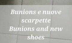 Bunions and new shoes