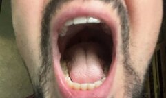 My burp and drool in your face 1