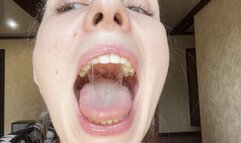 Extracting thick mucus