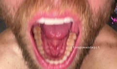 Andrew Teeth Bottom Molars and Retainer Part17 Video1 - WMV