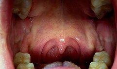 The Sounds of Digestion